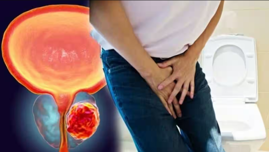 6 Signs and Symptoms of Serious Prostate Diseases